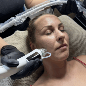 derma